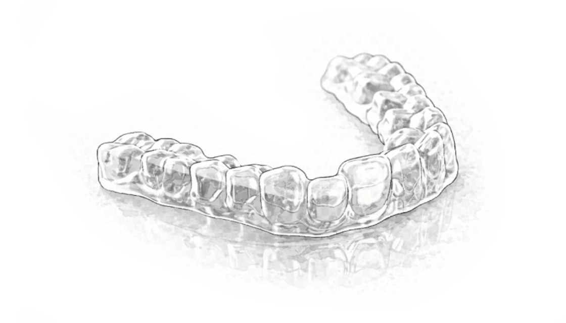 Aligner